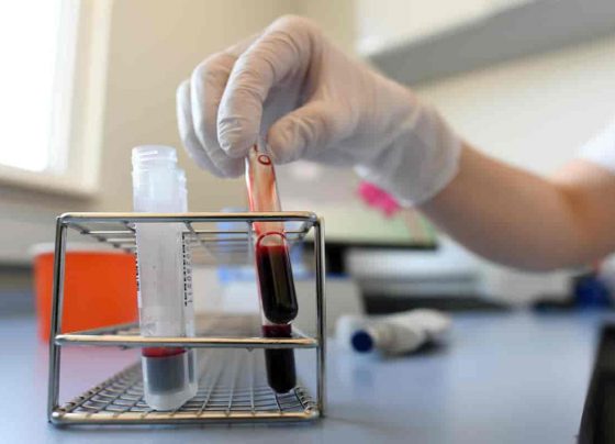 Corona,COVID-19,COVID,Coronavirus,COVID,European Countries,Europe COVID-19,Europe Coronavirus,COVID LockDown,Corona LockDown