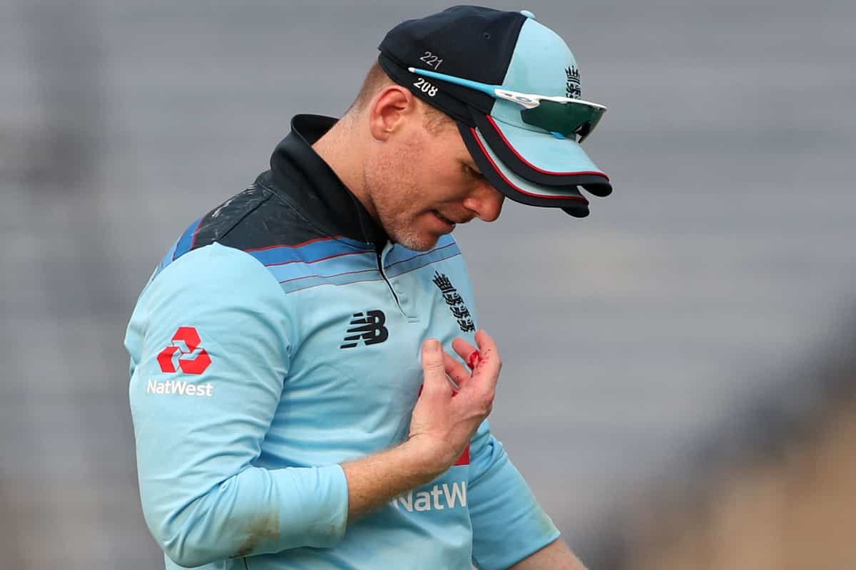 Injured Morgan, Billings doubtful for second ODI