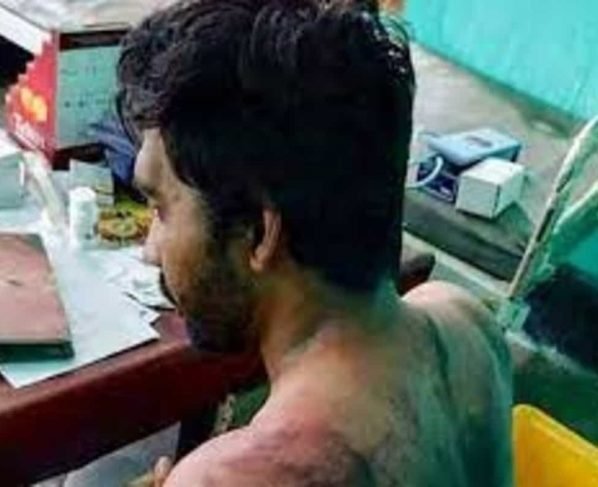 24 arrested for assaulting doctor at Assam’s Covid Care Centre