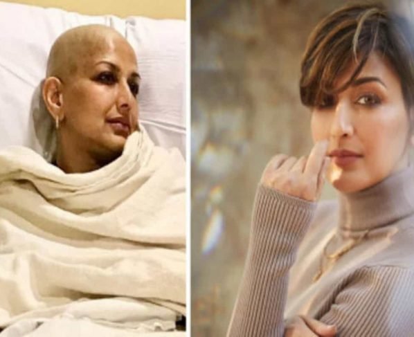 Sonali Bendre shares before-and-after picture on Cancer Survivors Day